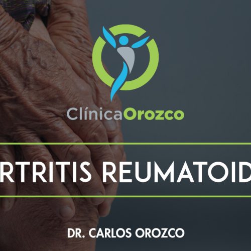 Clinica Orozco - Artritis reumatoide. Medicina Natural