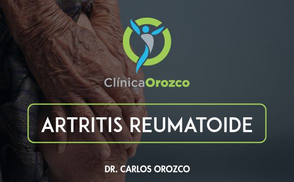 Clinica Orozco - Artritis reumatoide. Medicina Natural